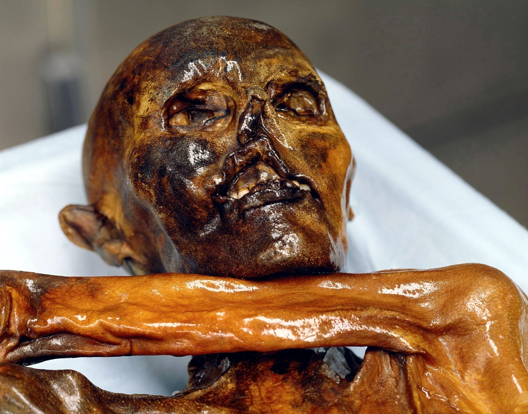 Ötzi war der erste tätowierte Mensch.